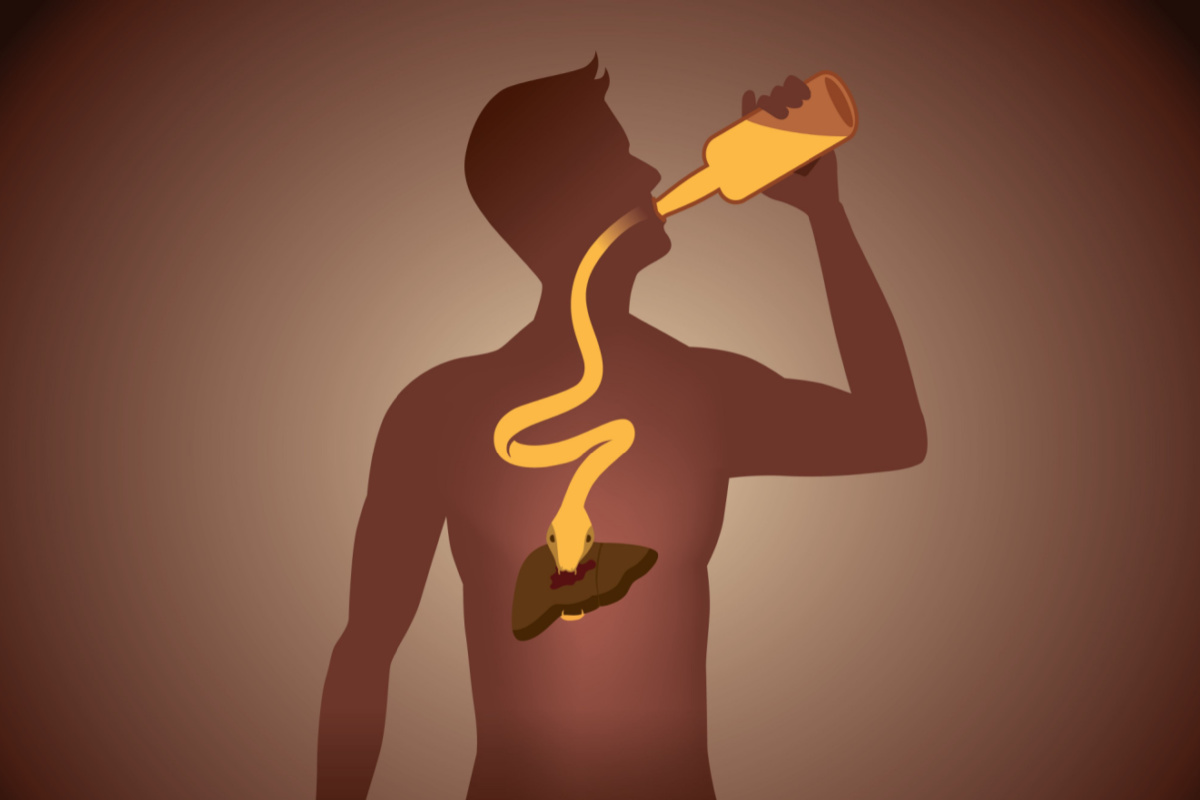 Alcoholic Liver Disease - Liver Health