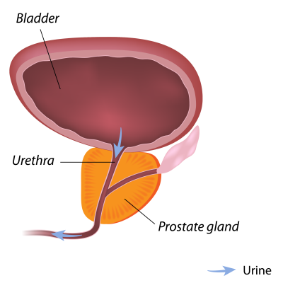Prostatis-01